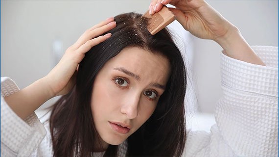 Struggling with Dandruff?